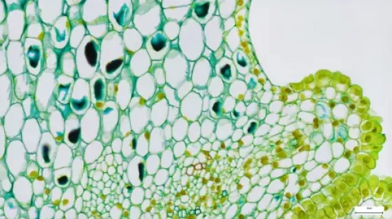 plant stem tissues